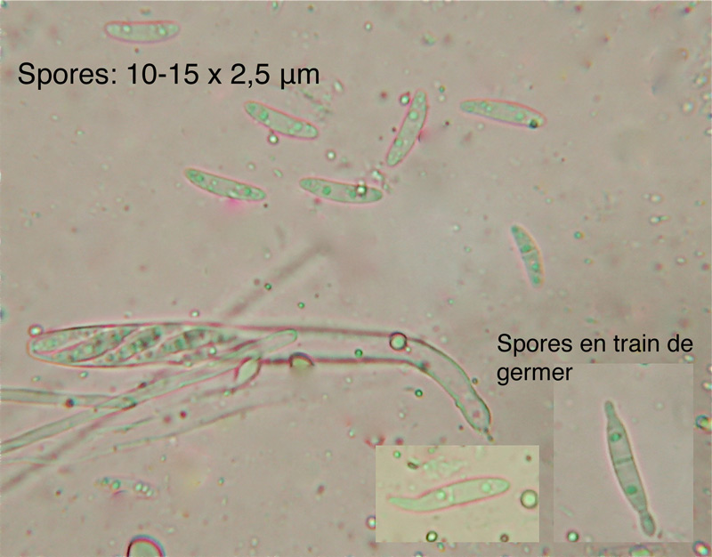 Chlorociboria-aeruginosa--.jpg