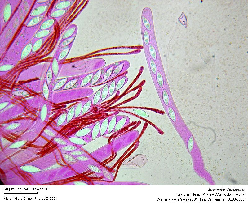 Inermisa_fusispora_micro.jpg