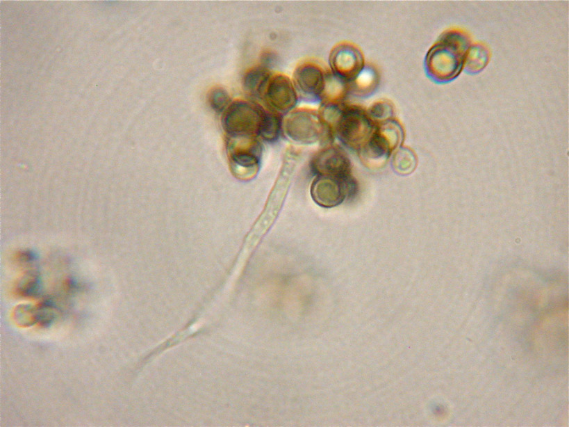 Cheirospora-botryospora22.jpg