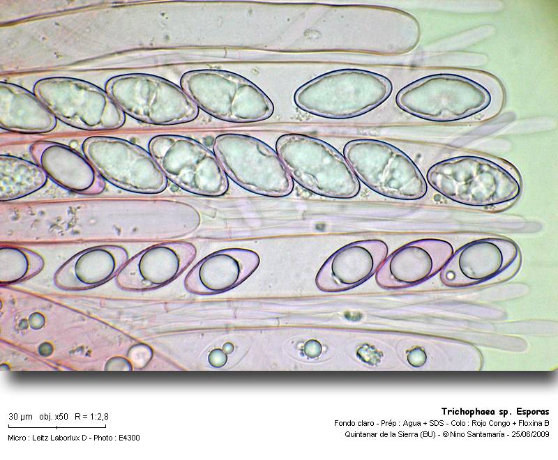 Trichophaea_sp_Esporas_090620.jpg