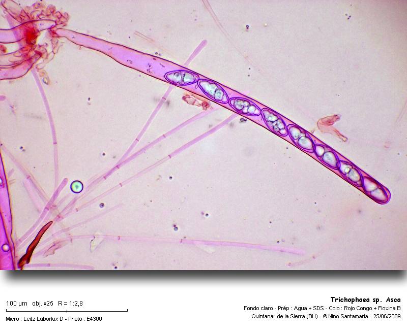 Trichophaea_sp_Asca_090620.jpg