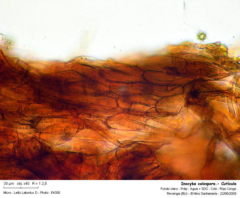 Inocybe_calospora-_Cuticula_090620.jpg