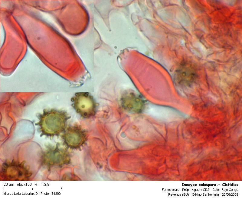 Inocybe_calospora-_Cistidios_090620.jpg