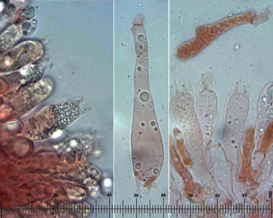 Tricholoma baside.jpg