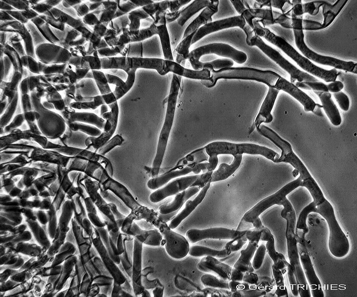 Hyphoderma setigerum cystides juvéniles ampullacées.jpg