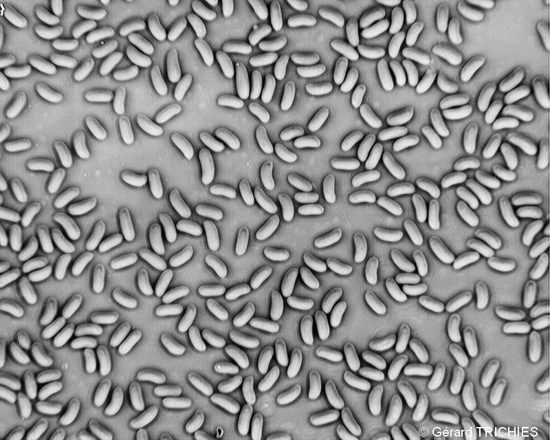 Hyphoderma setigerum spores 1.jpg