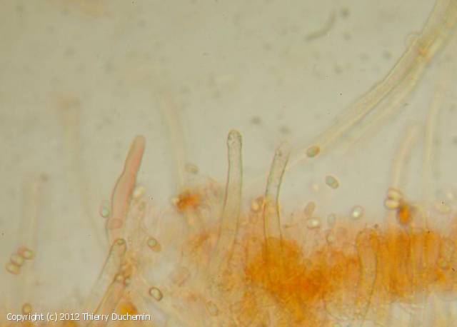 Amphinema Byssoides