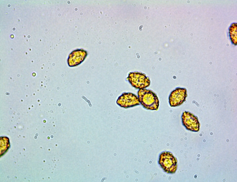 spores sp1à déterm-001.jpg