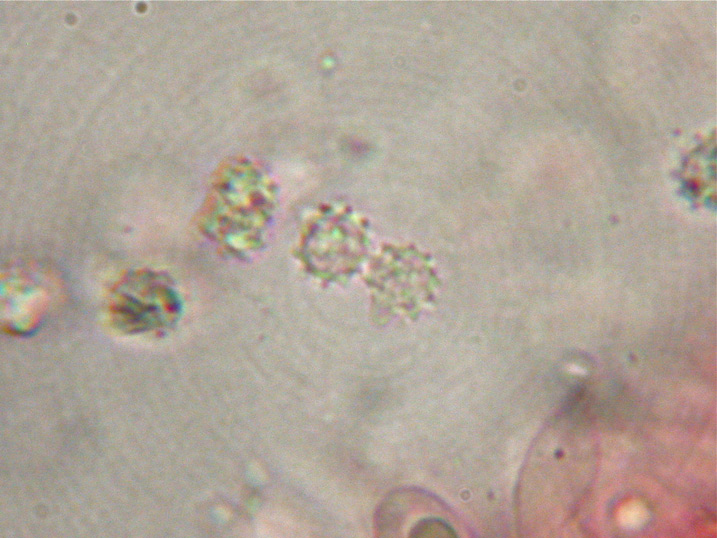 Spores-Bankera-violascens.jpg