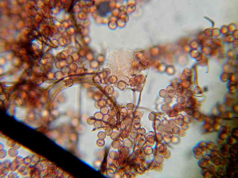 Spores_stemonitis.JPG