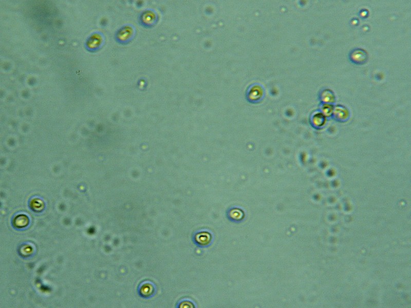 Spores du phellinus.jpg