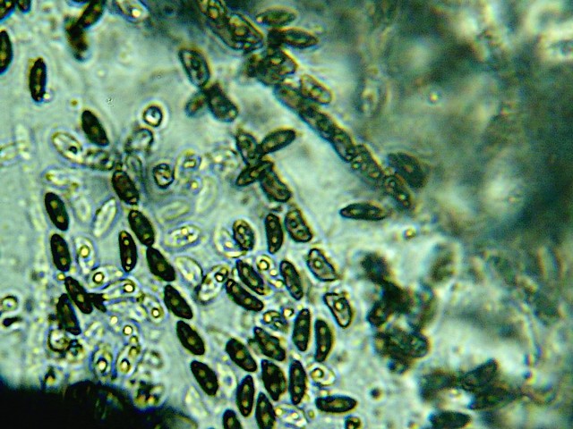 Spores sp 1.jpg