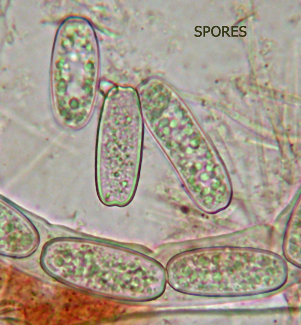 Spores-S-austriaca-copie.jpg