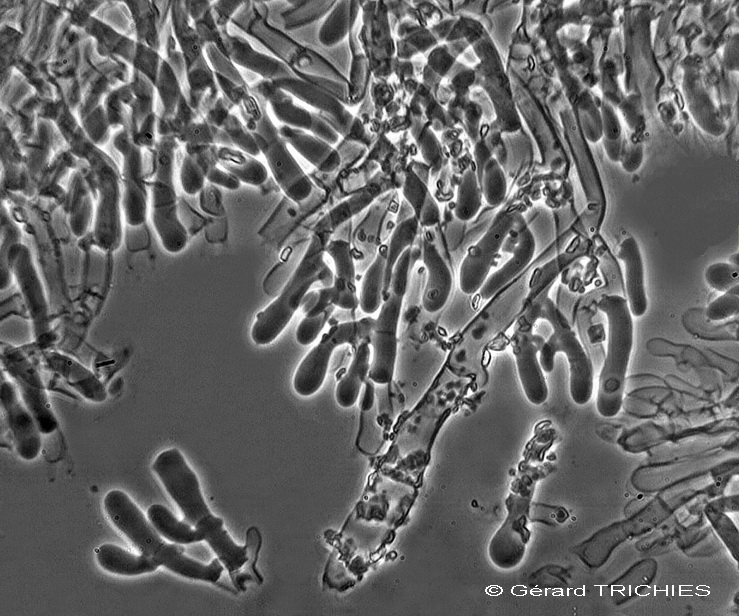 Hyphoderma setigerum septocystides 2.jpg