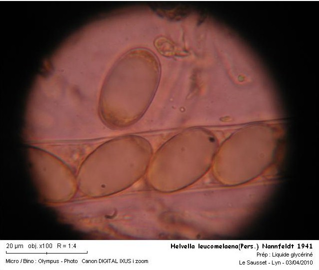 Helvella leucomelaena asque et spores.JPG