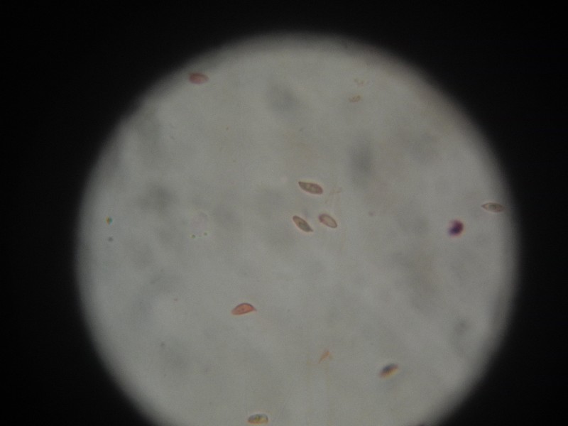 Lepiote Spores-redim800.JPG