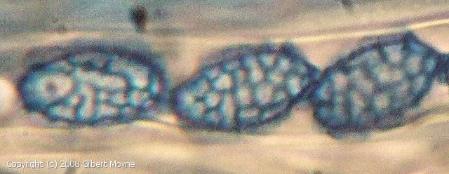 MycoDB Photos de champignons Sowerbyella rhenana