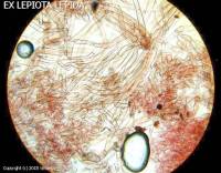 Fiche de Lepiota speciosa