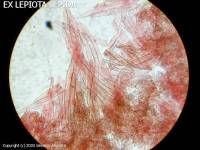 Fiche de Lepiota speciosa