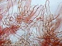 Fiche de Lepiota subgracilis