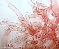 Fiche de Lepiota subgracilis